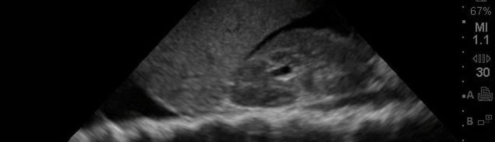SonoSpot: Topics in Bedside Ultrasound