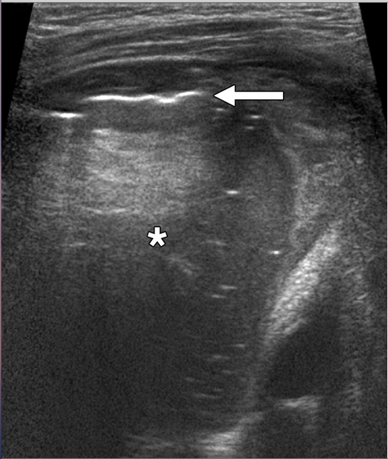 Screen shot 2012-12-17 at 8.23.05 PM