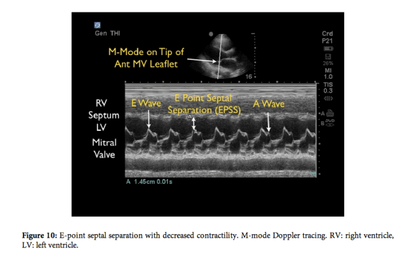 Screen shot 2012-12-17 at 8.30.49 PM