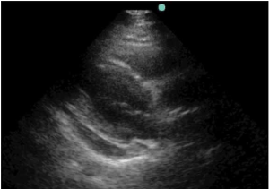 Screen Shot 2013-03-25 at 11.34.28 AM