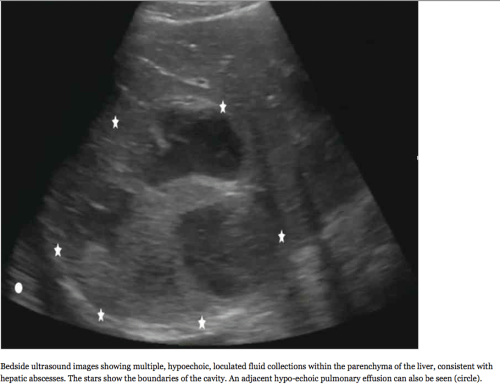 Screen Shot 2013-05-01 at 2.28.40 PM