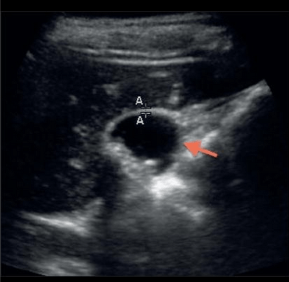 Screen Shot 2013-05-09 at 9.33.44 AM