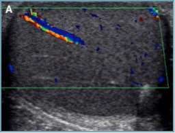 testicule normal flow
