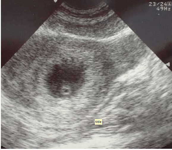 Screen Shot 2013-07-03 at 6.39.47 PM