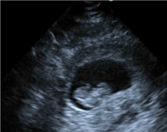 Screen Shot 2013-07-03 at 6.40.19 PM