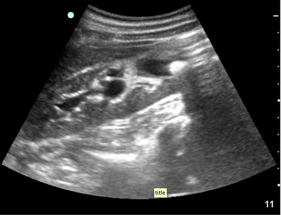 Screen Shot 2013-07-17 at 2.37.30 PM