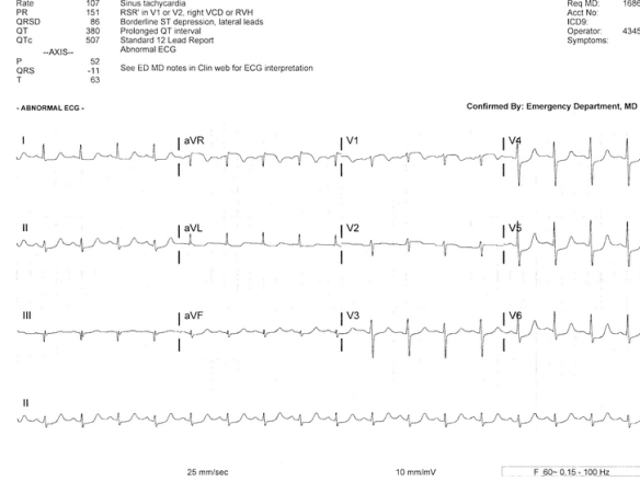 Screen Shot 2013-08-22 at 6.21.37 PM