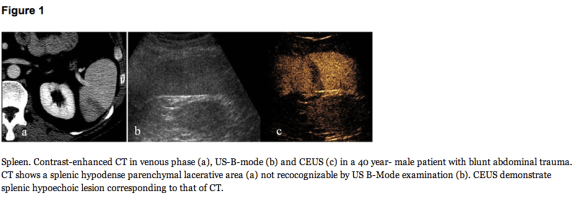 Screen Shot 2013-08-27 at 7.27.41 PM