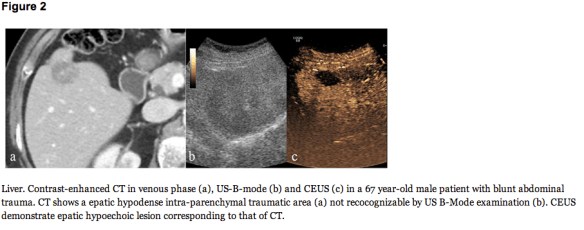 Screen Shot 2013-08-27 at 7.28.21 PM