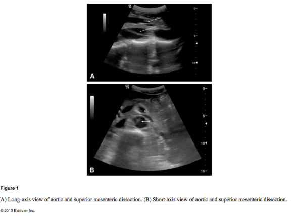 Screen Shot 2013-09-03 at 9.54.59 AM