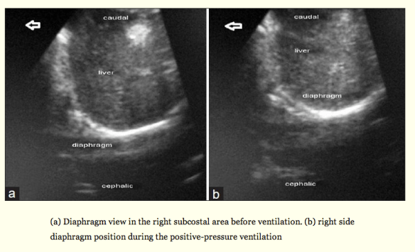 Screen Shot 2014-04-02 at 10.15.58 AM