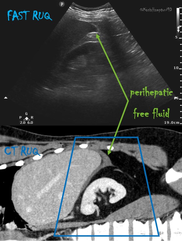 Seek and ye shall find 3