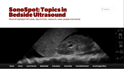 Screen Shot 2013-11-25 at 3.24.52 PM