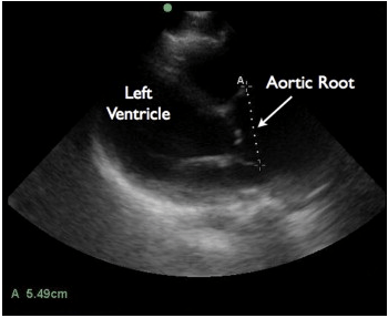 Screen Shot 2014-03-04 at 9.16.55 AM