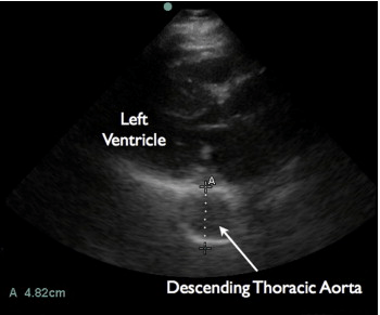 Screen Shot 2014-03-04 at 9.17.06 AM