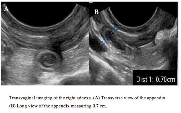 Screen Shot 2014-05-23 at 1.38.05 PM