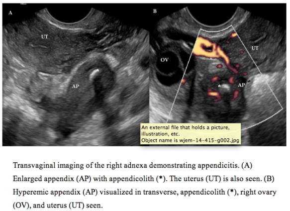 Screen Shot 2014-05-23 at 1.38.12 PM